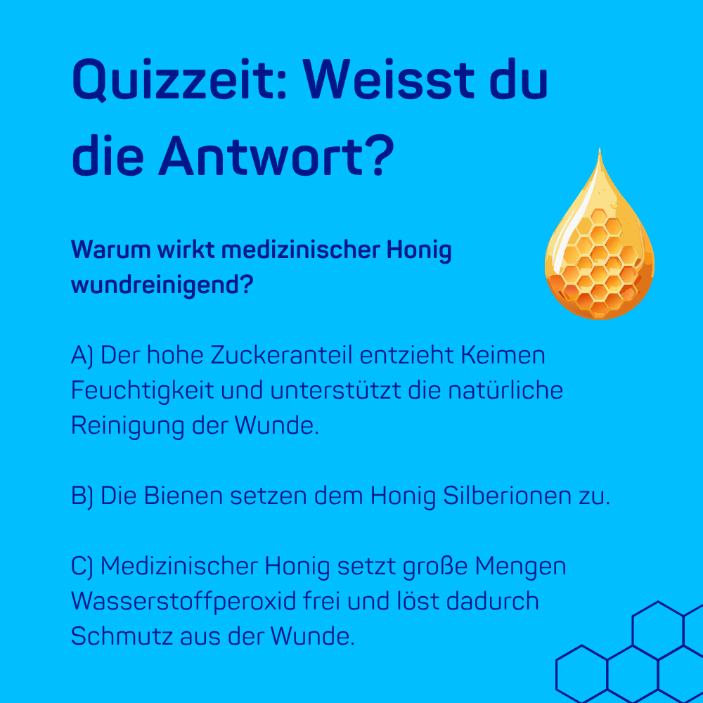Quizzeit: Weisst du die Antwort?