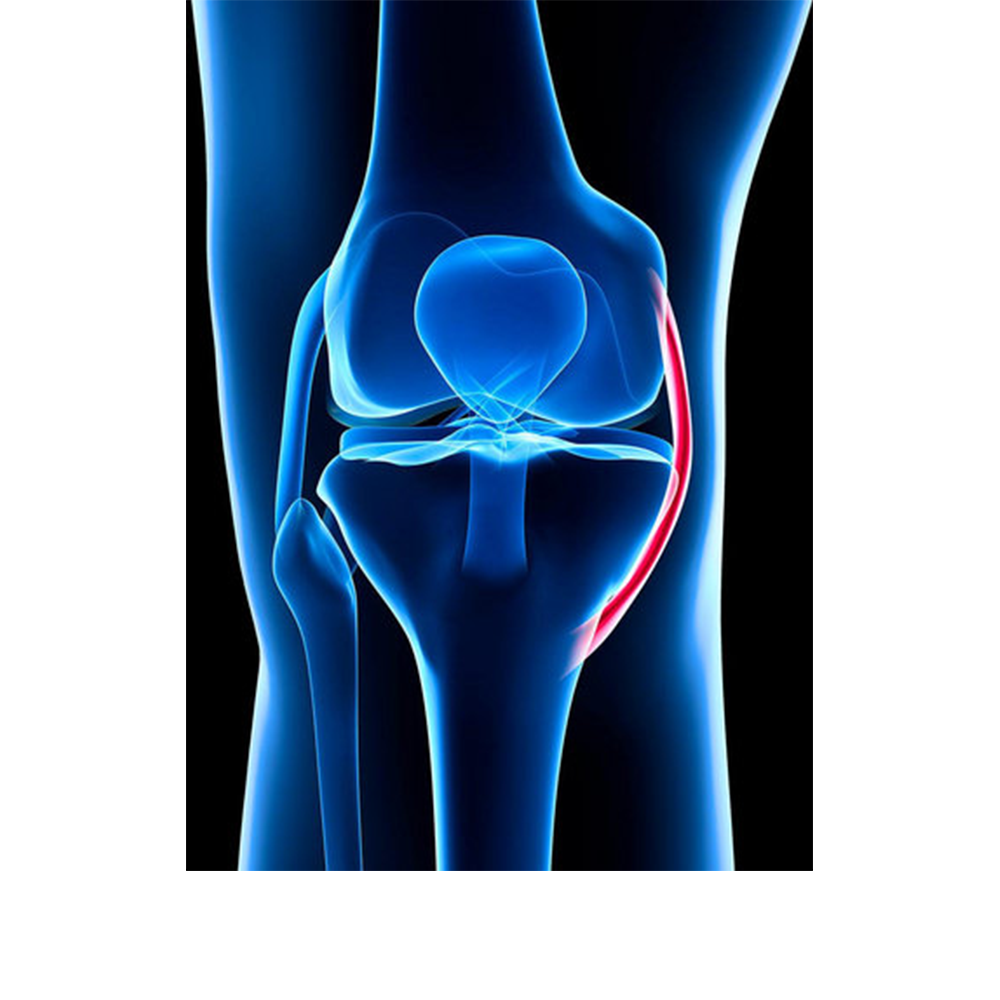 Grafik Bänder im knie