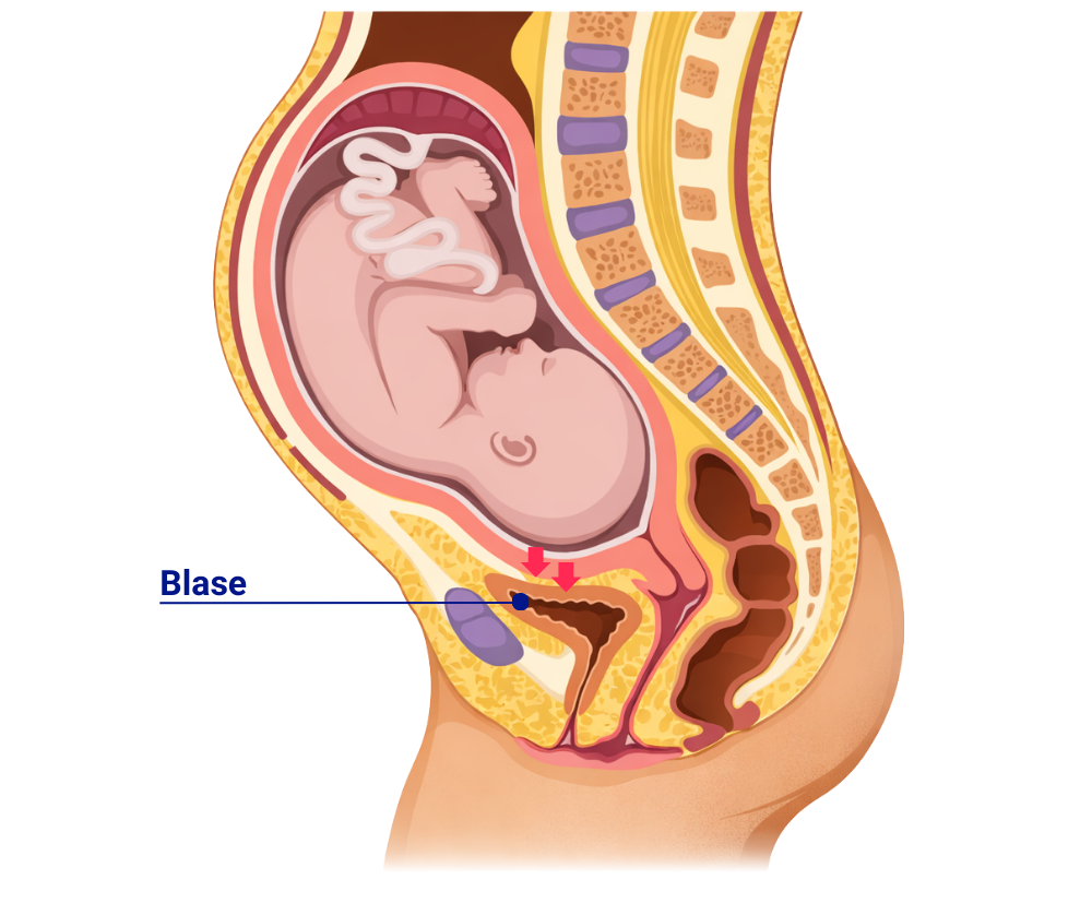 Grafik eines Fötus im Bauch