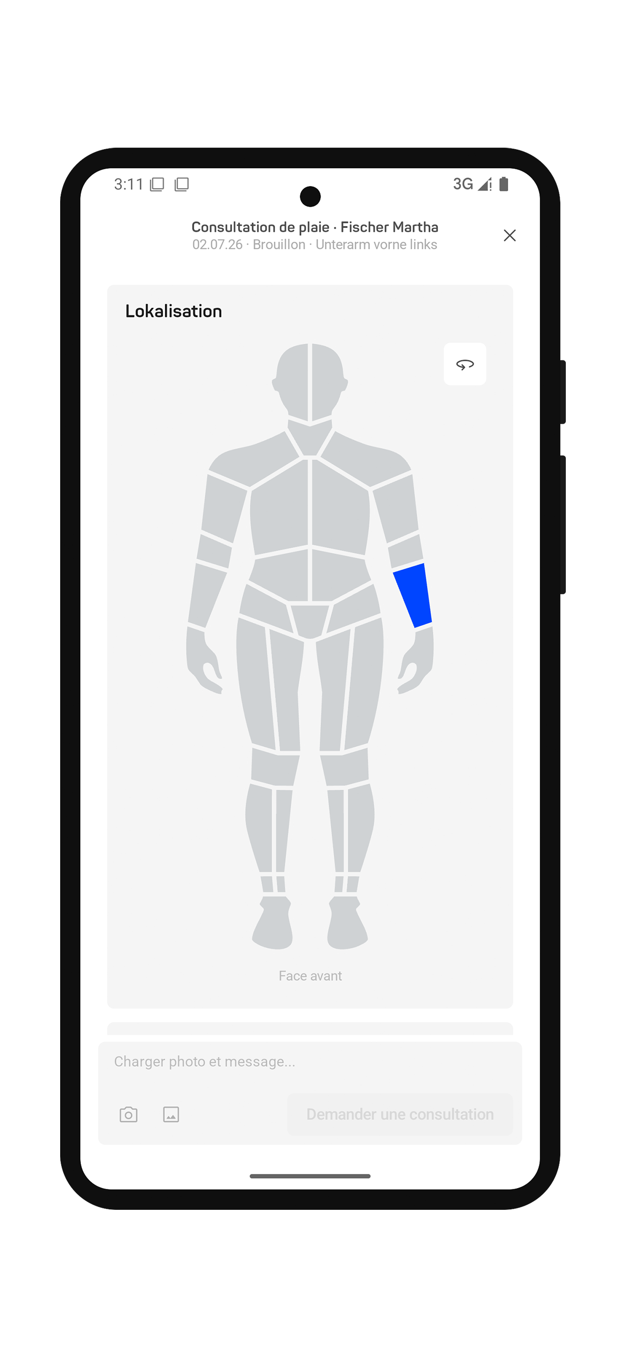 App FR wound consultation framed