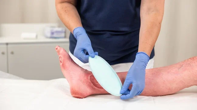 Anwendungsbeispiel der Wundauflage Zetuvit Plus