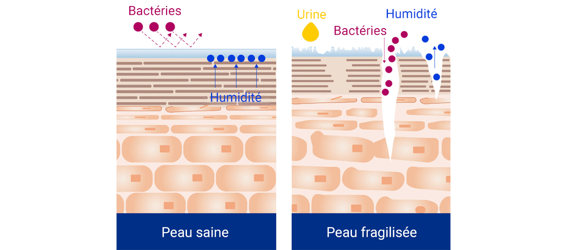 Graphique peau saine - peau affaiblie