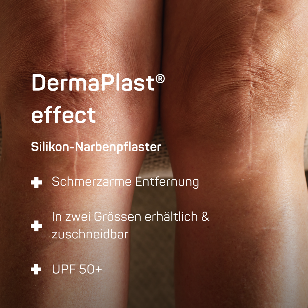 DermaPlast® effect - Silikon Narbenpflaster: Narben sind sehr vielfältig