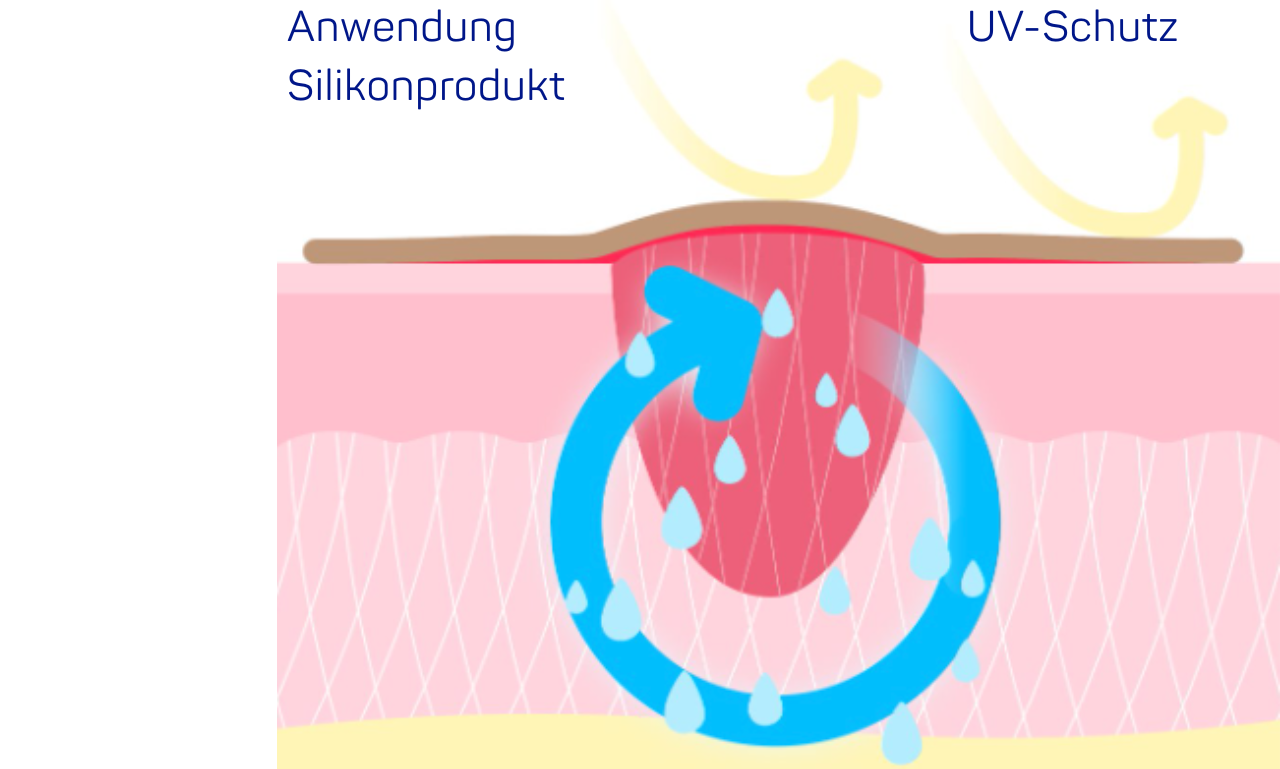 DP Effect AnwednungSilikonprodukt 1280x769