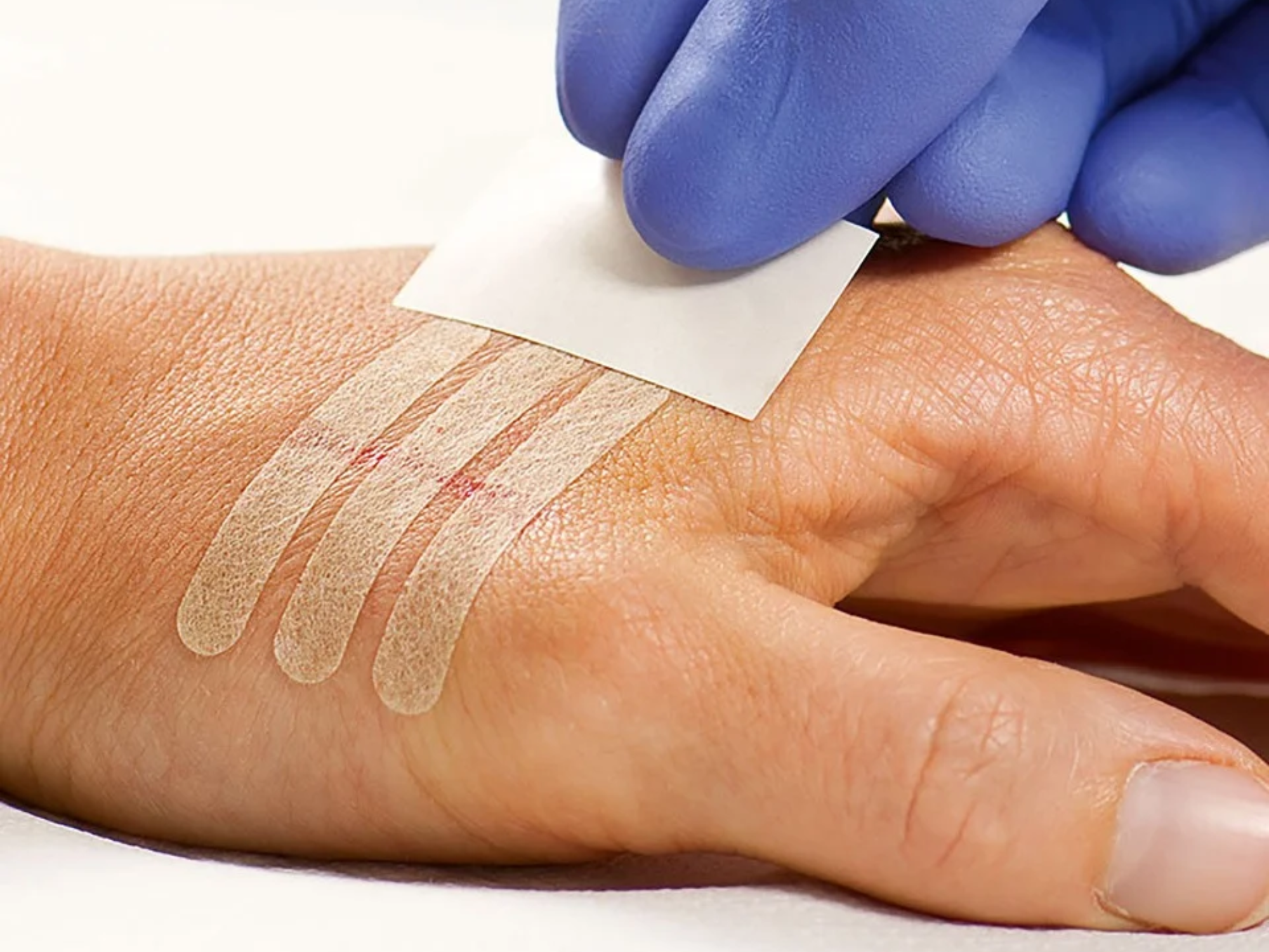 DermaPlast® MEDICAL cerotti di sutura rinforzato