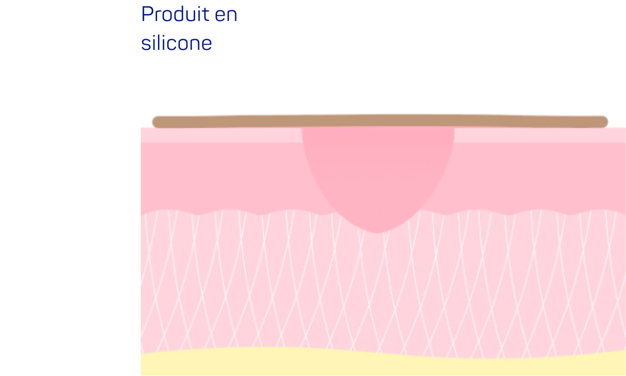 DP Effect Silikonprodukte 1280x769 FR