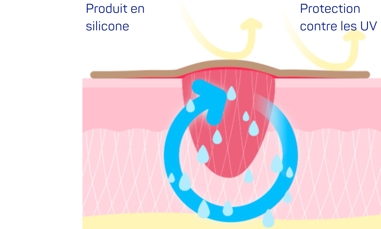 DP Effect AnwednungSilikonprodukt 1280x769 FR