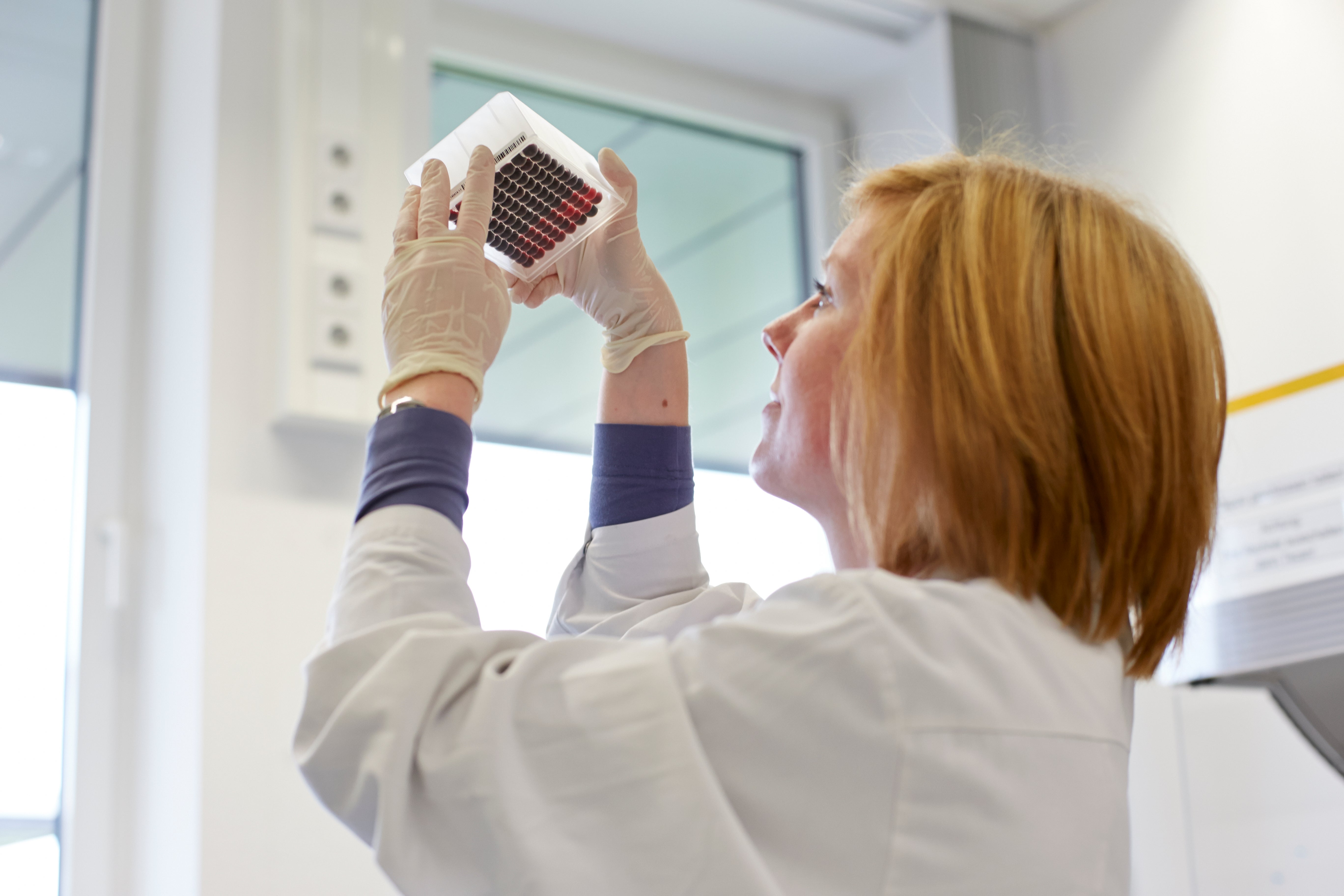 In the DKMS Life Science Lab, an employee checks a prepared blood sample panel for the correct fill level.