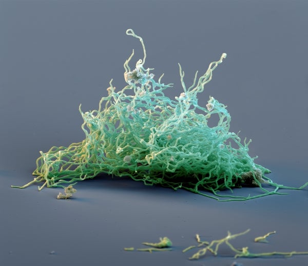 Borrelia burgdorferi