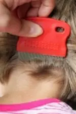 Pidocchio del capo - Informazioni sulla prevenzione