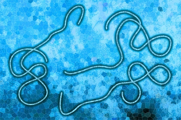 Ebola-Viruserkrankung aus der Demokratischen Republik Kongo und Uganda (Foto:123rf)