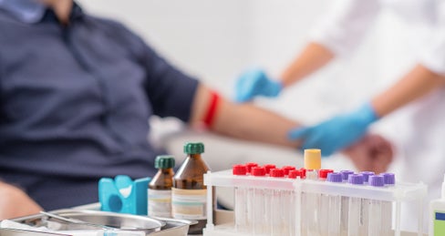 Neuerungen bei Absagen von Laborterminen ab November (Foto: 123rf)