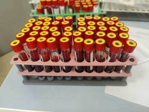 Hepatits-C-Vorsorge - Blutproben   