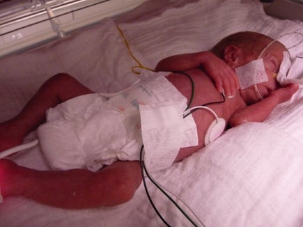 Bei der Geburt wog Niklas nur 530 Gramm, Foto privat