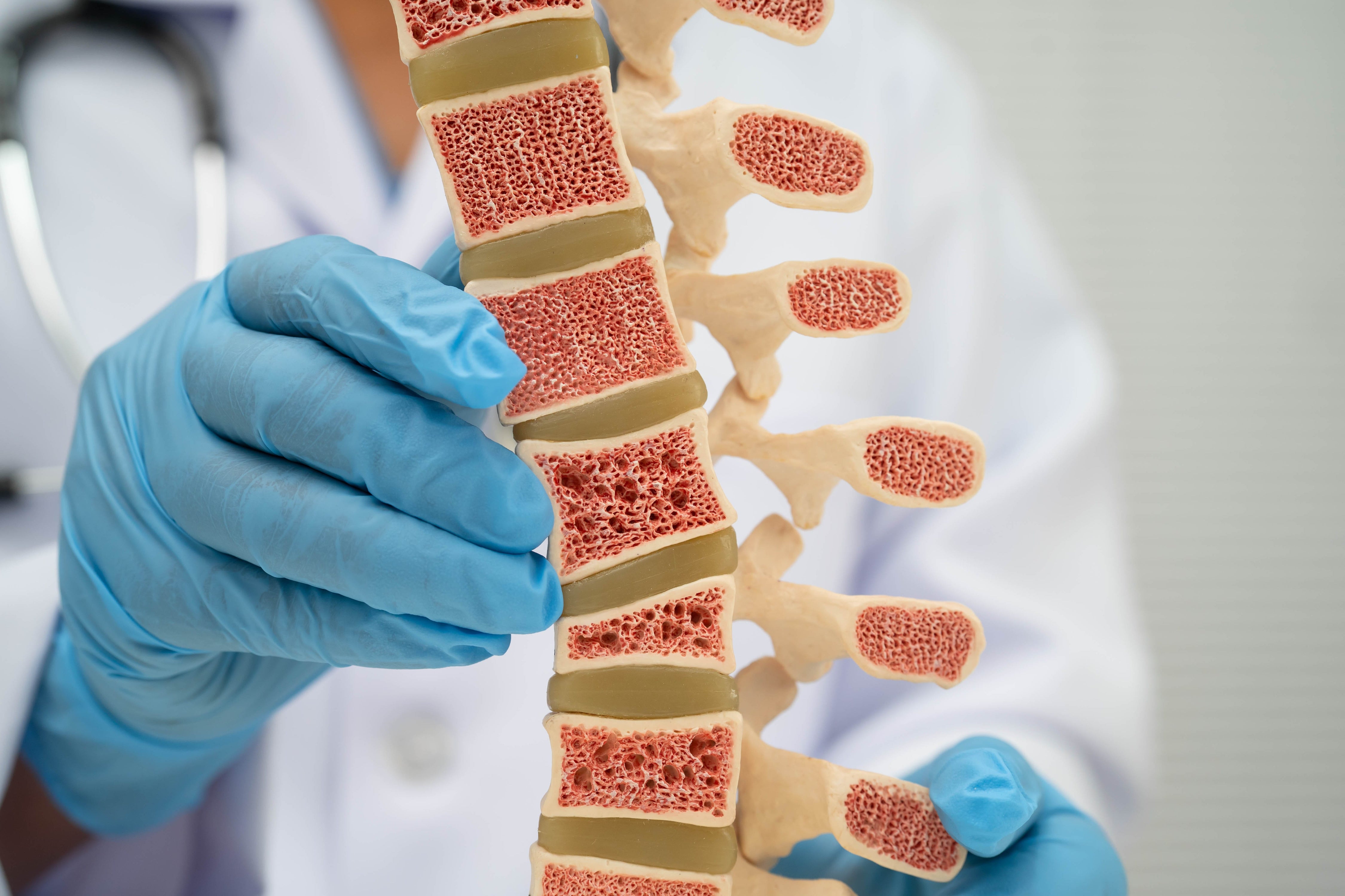 Presso la Casa della Comunità di Chiusa è ora attivo un Ambulatorio specializzato in osteoporosi. (foto 123rf. Può essere utilizzata solo per la pubblicazione di questo testo)