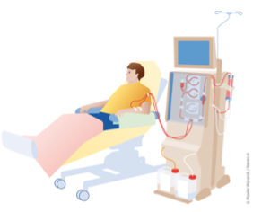 Animatie afbeelding van een persoon die dialyse ondergaat. 