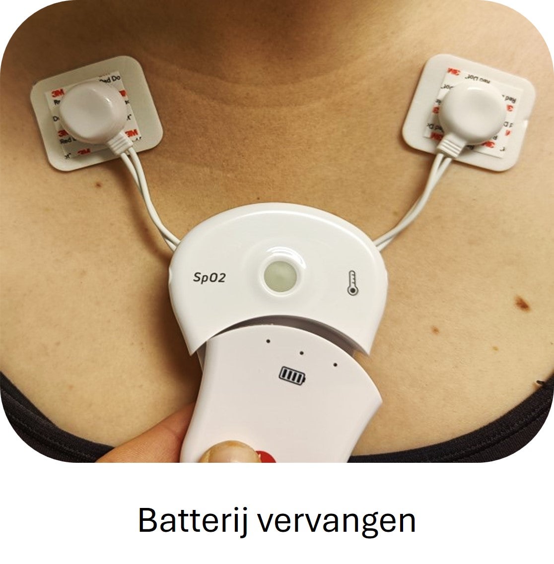 Het verwisselen van de batterij