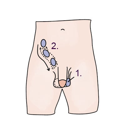 Indaling van de teelballen