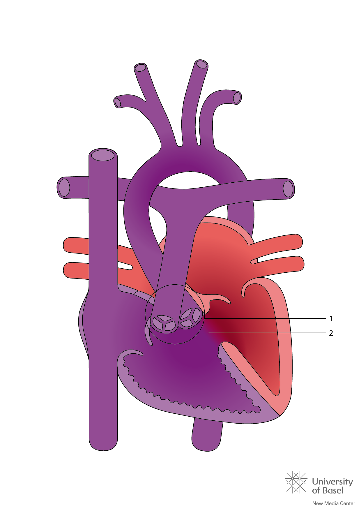 Hart met een rechter hartkamer met dubbele uitgang