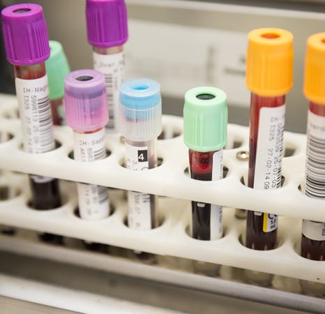 Een groep reageerbuizen in een rek