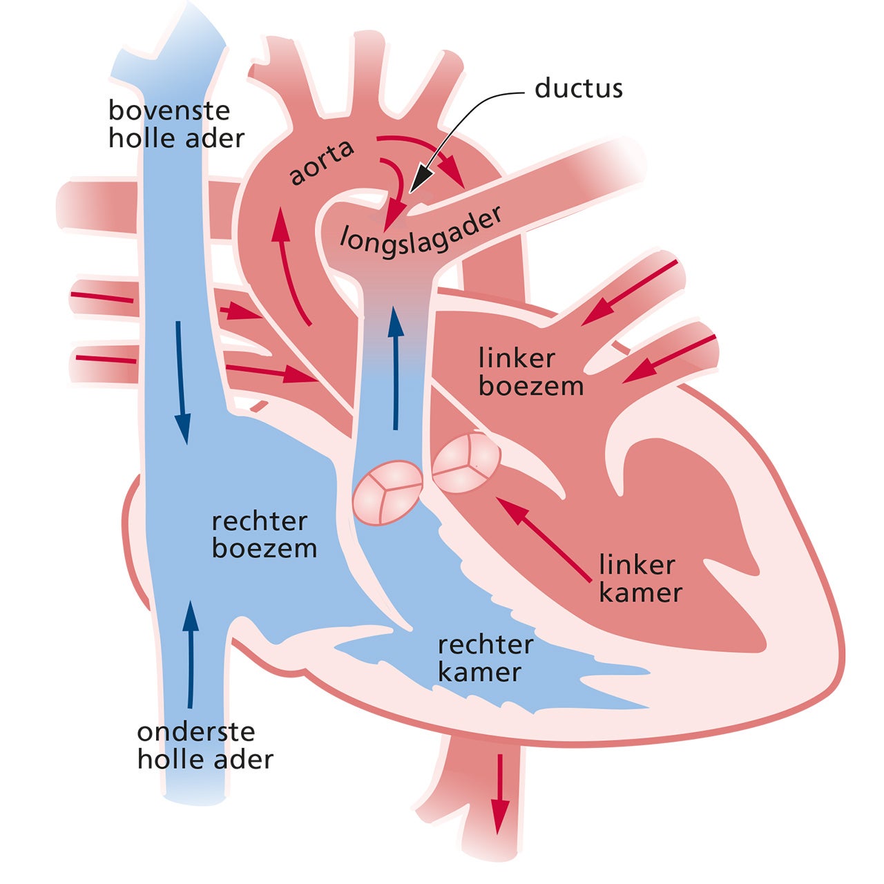 Persisterende Ductus Arteriosus Centrum Voor Aangeboren