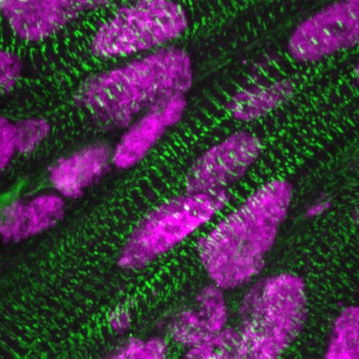 Aanwezigheid van ARID1A (roze) in de celkernen van hartspiercellen (groen), een aantal dagen na de geboorte