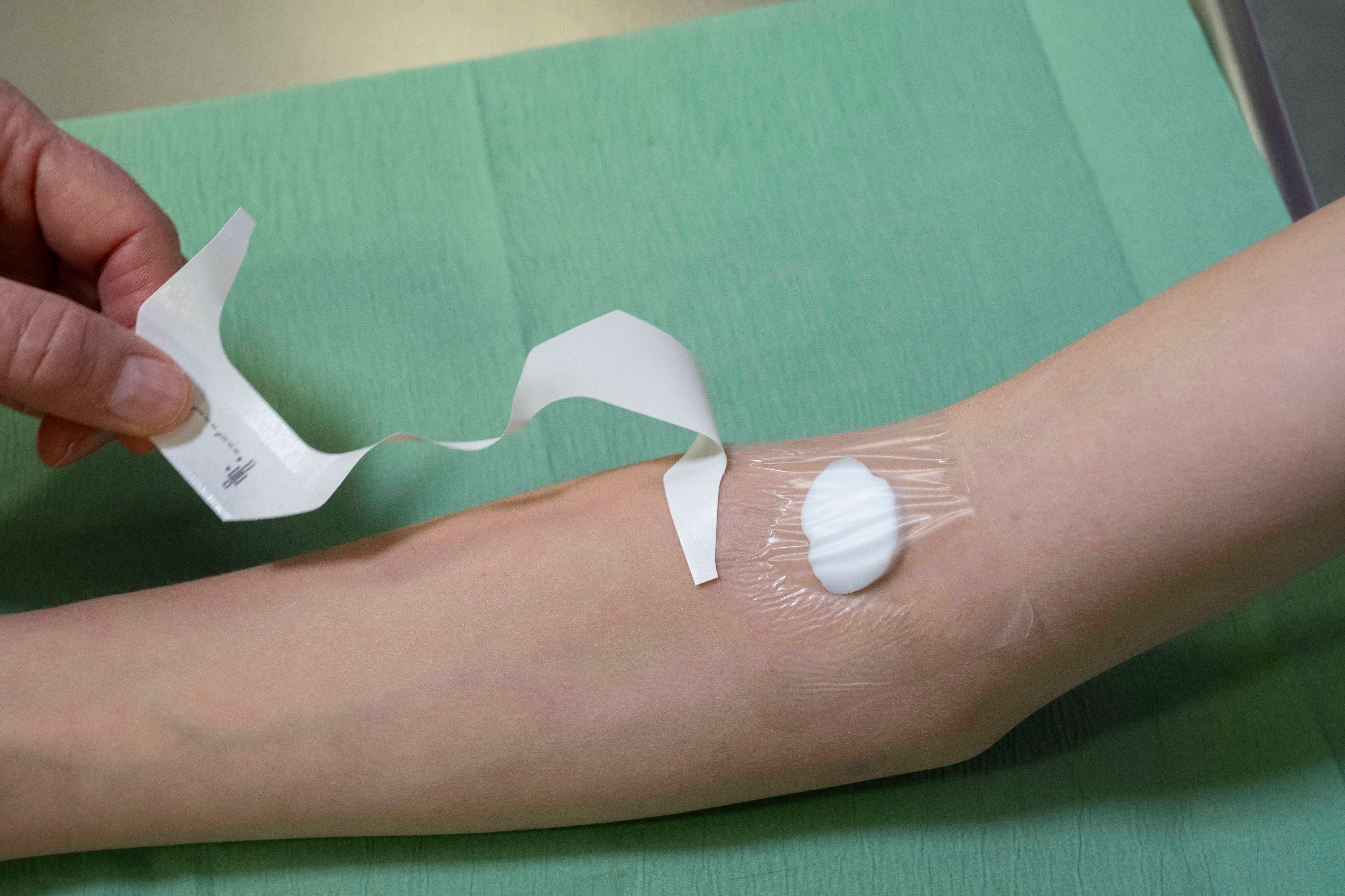 randje van EMLA pleister weghalen 