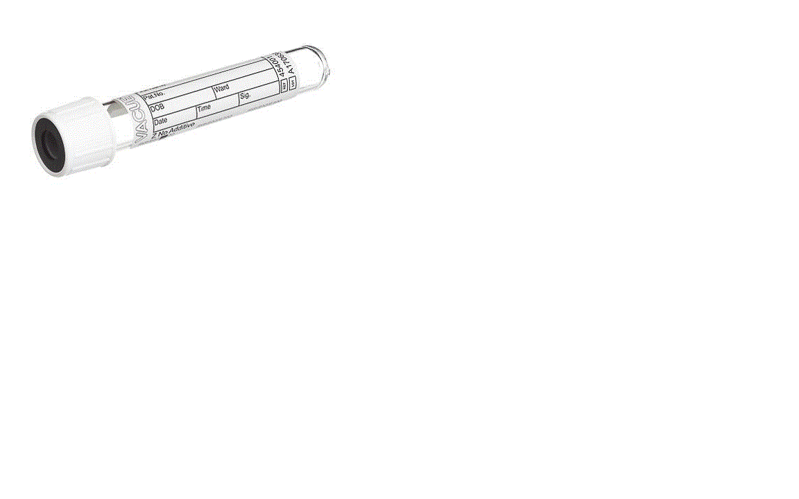 Eurotherm Solar losse vacuümbuis met heatpipe