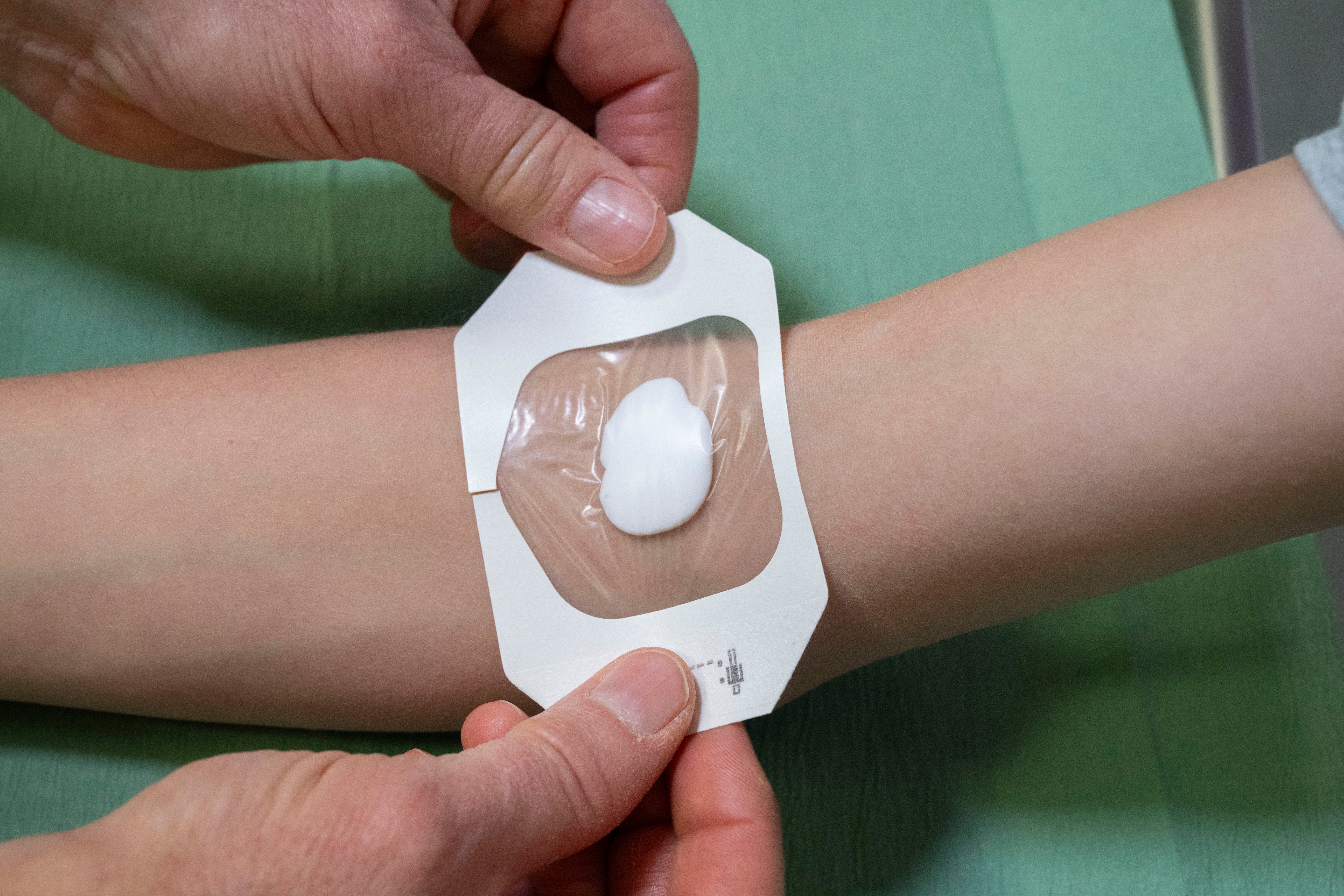 EMLA afdekken met pleister