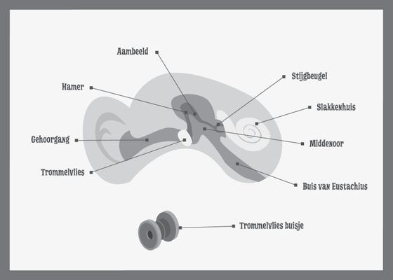 Trommelvliesbuisjes plaatsen - Het WKZ Trommelvliesbuisjes Plaatsen - Het Wkz
