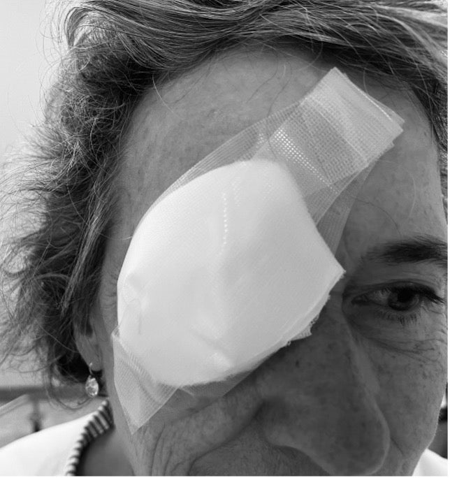 Zalfdrukverband op oog