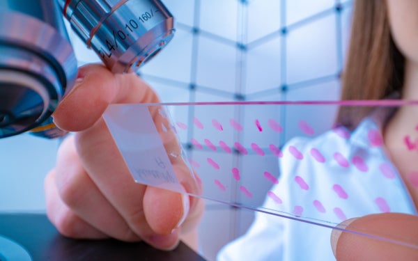 Wetenschapper bekijkt een microscoopplaatje in een laboratorium.