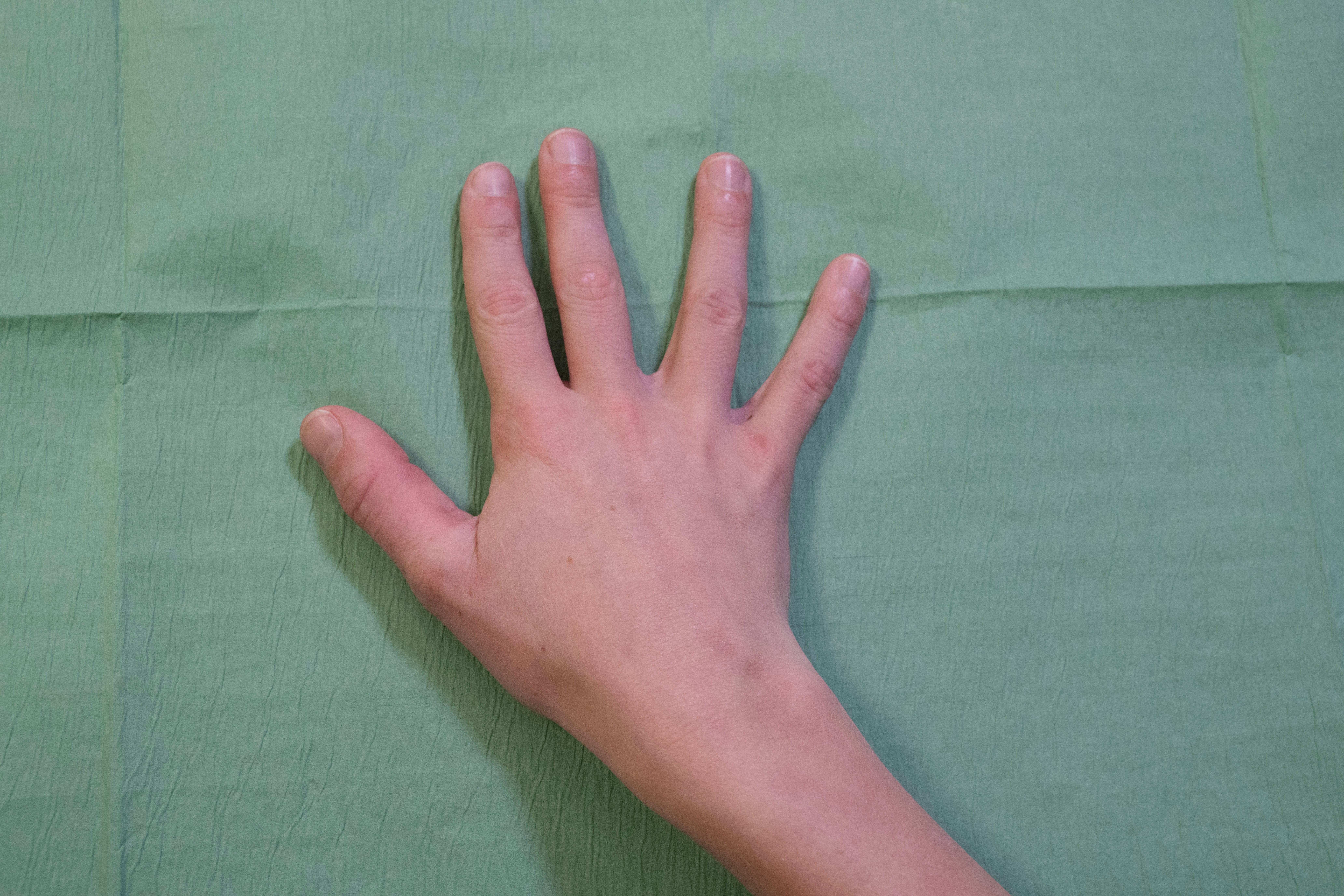 hand klaar voor EMLA zalf