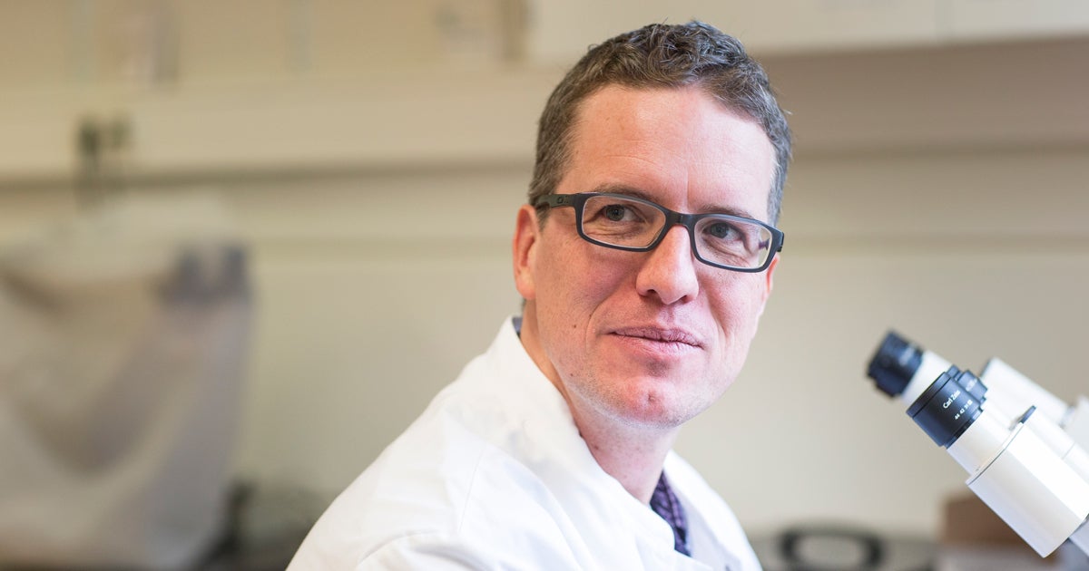 Onderzoek naar erfelijk afval bij epilepsie UMC Utrecht