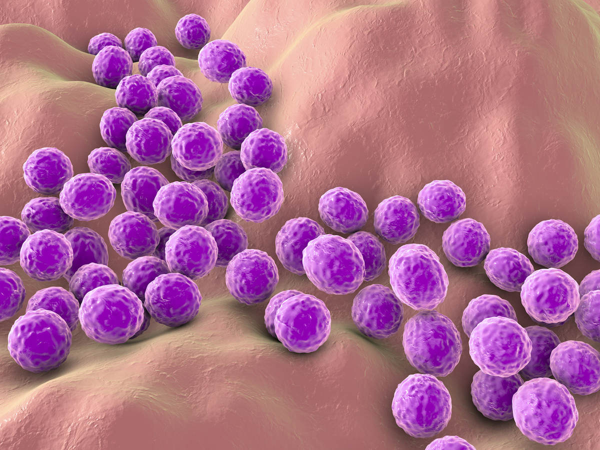 Staphylococcus aureus 