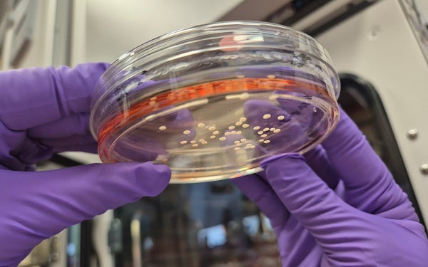 Onderzoek van Noelia Antón Bolaños