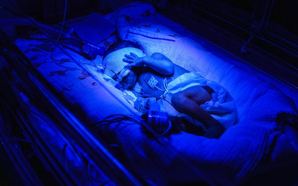 Baby couveuse blauw licht