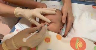 脳損傷のある赤ちゃんのための幹細胞点鼻薬