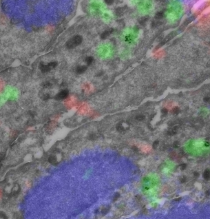 EMBO Practical Course on Correlative Light & Electron Microscopy