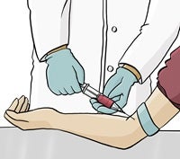 Im Gesundheits·sprengel nehmen die Mitarbeiterinnen und Mitarbeiter Blut ab.