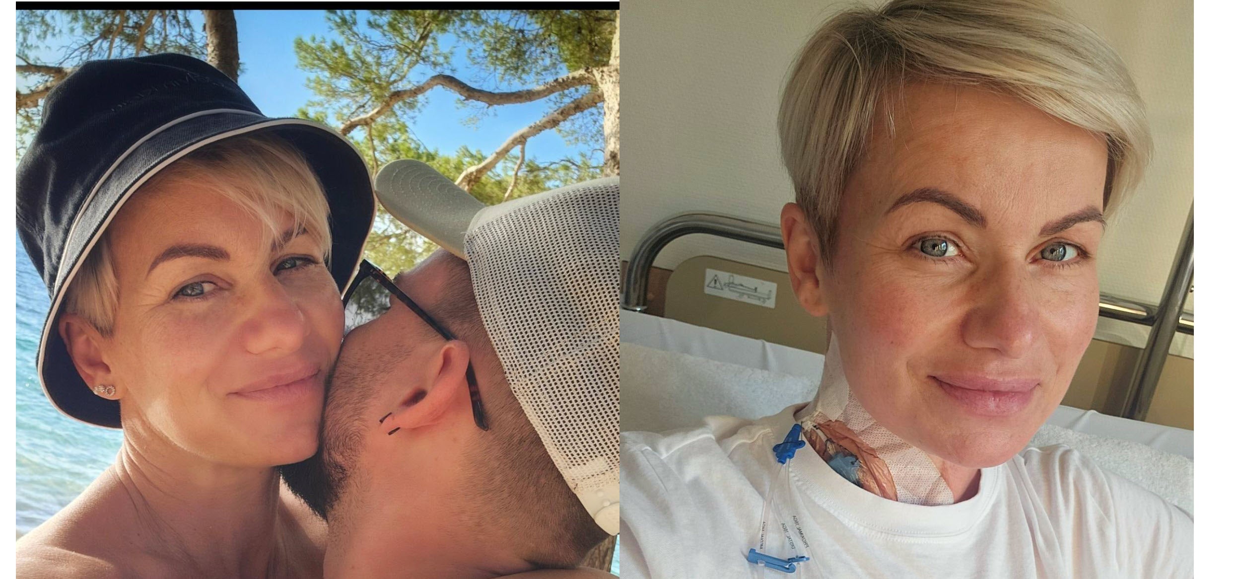 Fotocollage aus zwei nebeneinander angeordneten Bildern.
Linkes Bild: Auf dem Portätfoto trägt Peggy einen dunkelgrauen Fischerhut. Ihr Partner steht mit dem Rücken zur Kamera und umarmt sie. Peggy lächelt leicht schelmisch über seine Schulter in die Kamera. Im sonnigen Hintergrund sind Wasser und Äste zu erkennen.
Rechtes Bild: Auf dem Porträtselfi trägt Peggy ein weisses T-Shirt und sitzt auf einem Krankenhausbett. Sie hat Pflaster am Hals und Schläuche die daran herunterlaufen. Sie lächelt in die Kamera.