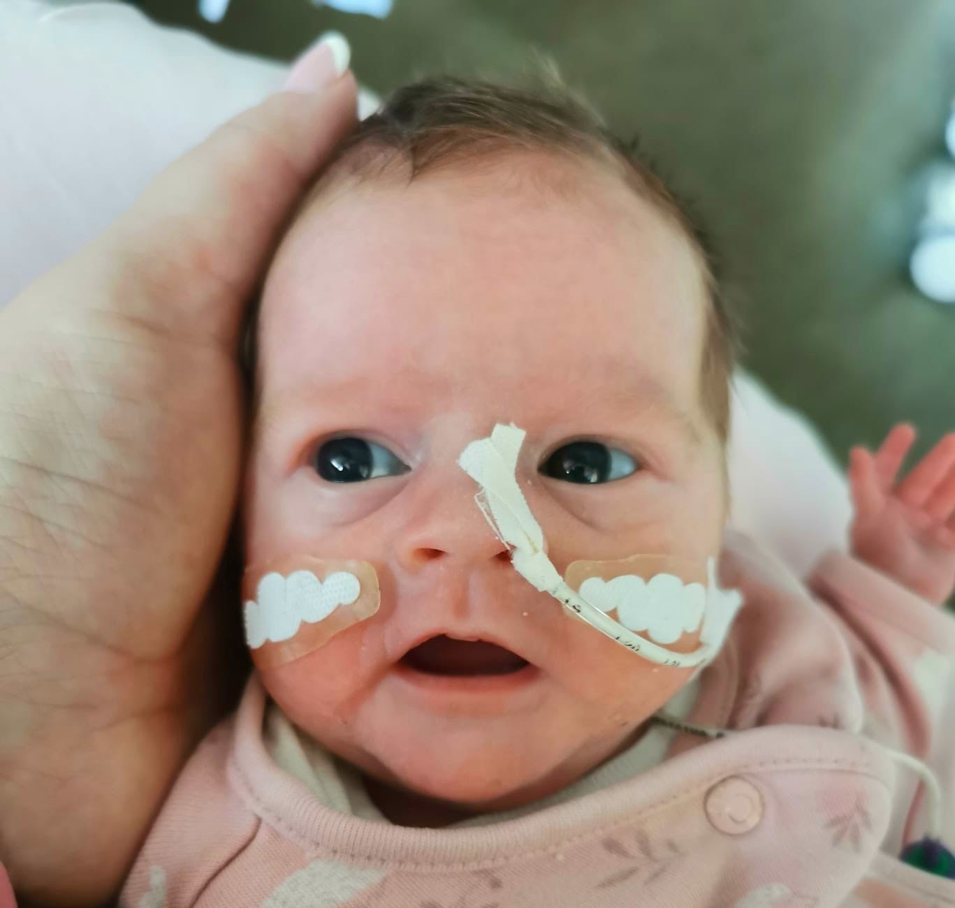 Foto von einem kleinen Kind mit Schläuchen in der Nase