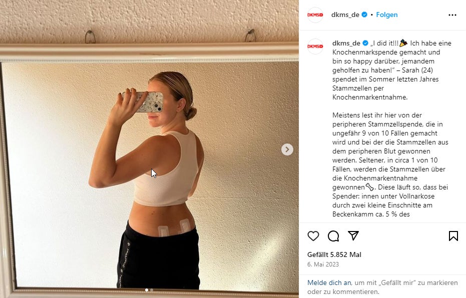 Screenshot von einem Instagram Beitrag: eine Frau macht ein Spiegelbild nach einer Knochenmarkentnahme