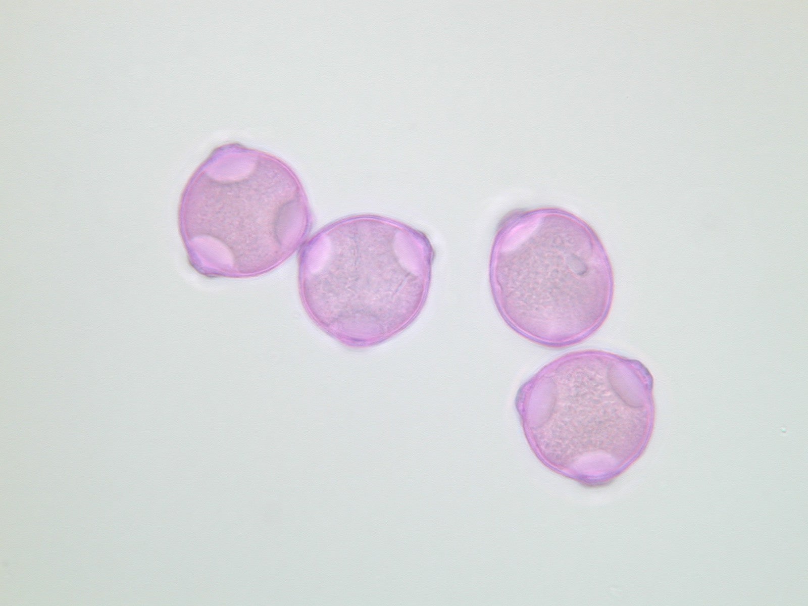 Lichtmikroskopische Aufnahme von mit Fuchsin gefärbten Pollen der Hopfenbuche (Foto: Landesagentur für Umwelt und Klimaschutz)