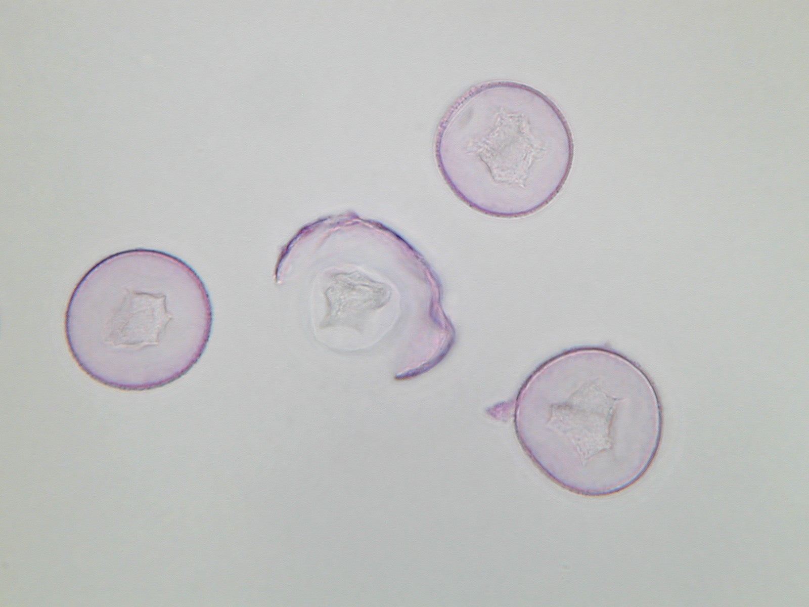 Lichtmikroskopische Aufnahme von mit Fuchsin gefärbten Pollen der Zypresse (Foto: Landesagentur für Umwelt und Klimaschutz)