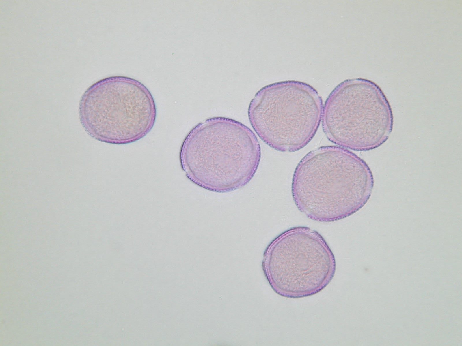 Lichtmikroskopische Aufnahme von mit Fuchsin gefärbten Pollen der Gemeinen Esche, Oberfläche mit genetztem Muster (Foto: Landesagentur für Umwelt und Klimaschutz)