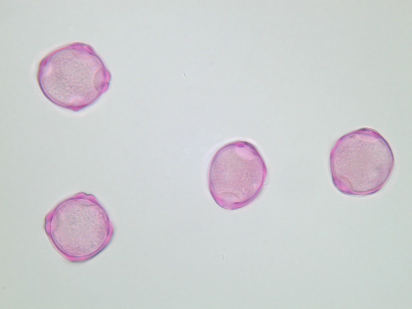 Lichtmikroskopische Aufnahme von mit Fuchsin gefärbten Pollen der Erle (Foto: Landesagentur für Umwelt und Klimaschutz)