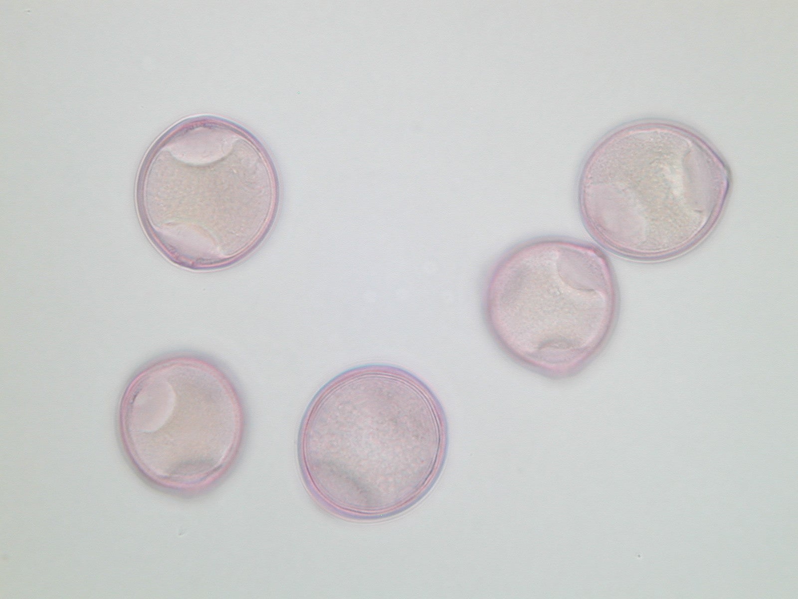 Lichtmikroskopische Aufnahme von mit Fuchsin gefärbten Pollen der Hasel (Foto: Landesagentur für Umwelt und Klimaschutz)