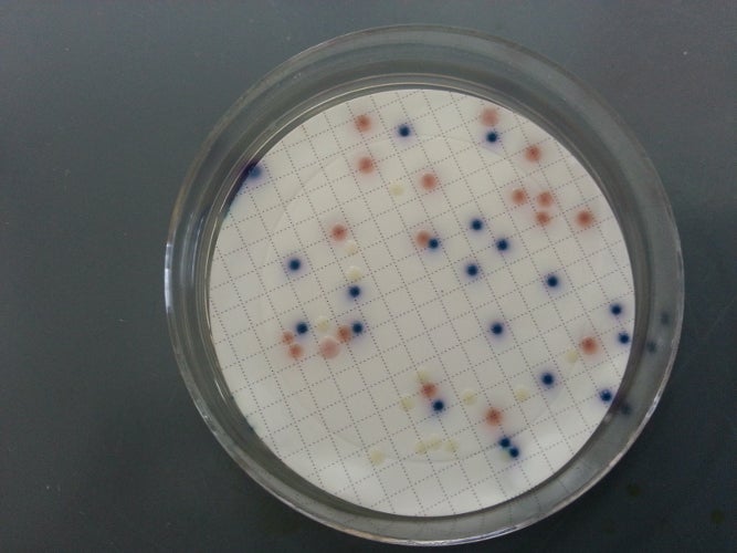 Nach erfolgter Bebrütung: Überprüfung des Kolonienwachstums (KbE, koloniebildende Einheit) und Auszählung der Kolonien (Foto: Landesagentur für Umwelt und Klimaschutz)