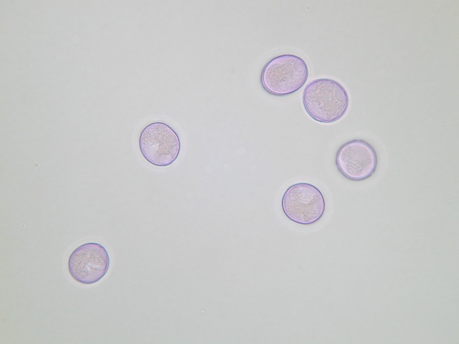 Lichtmikroskopische Aufnahme von mit Fuchsin gefärbten Brennnessel-Pollen (Foto: Landesagentur für Umwelt und Klimaschutz)